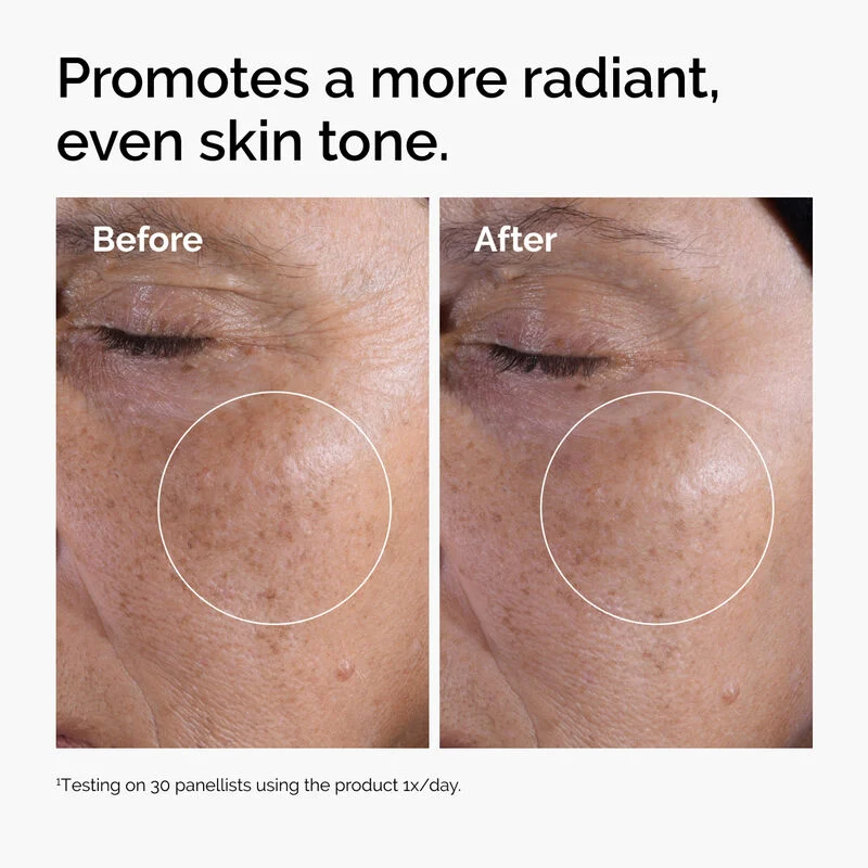 The Ordinary - Glycolic Acid 7% Exfoliating Toner